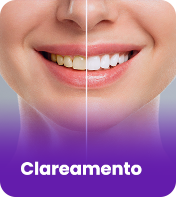 CLAREAMENTO