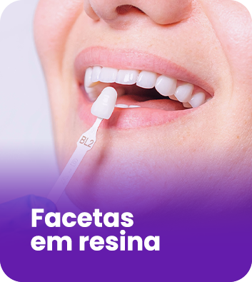 FACETAS-DE-RESINA